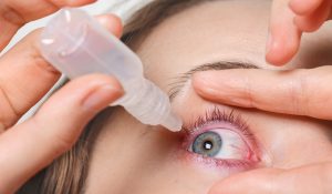 Close up shot of female pours drops in red eye, has conjuctivitis or glaucoma, bad eyesight and pain. Eyes pain treatment concept. Woman cures red blood eye